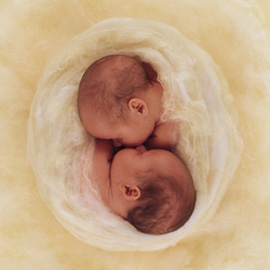 Image hébergée par Casimages.com : votre hébergeur d images simple et gratuit