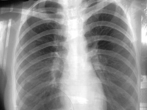 Image hébergée par Casimages.com : votre hébergeur d images simple et gratuit