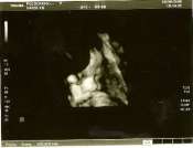 Hebergement gratuit d image et photo