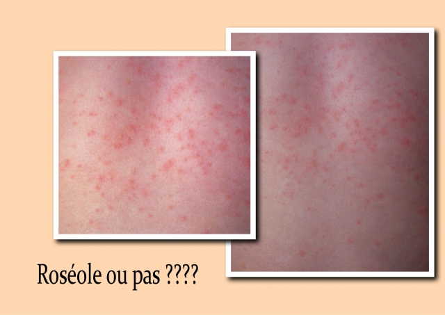 Image hébergée par Casimages.com : votre hébergeur d images simple et gratuit