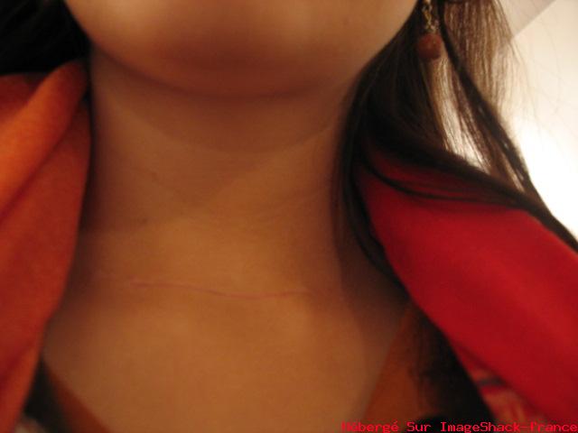 Alixer2