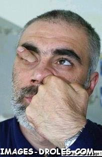 fingerhead