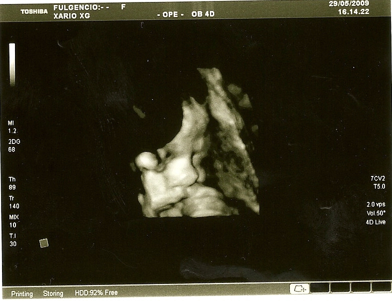 num&Atilde;&copy;risation0007